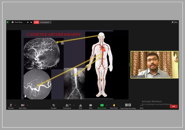 Workshop on Angiography